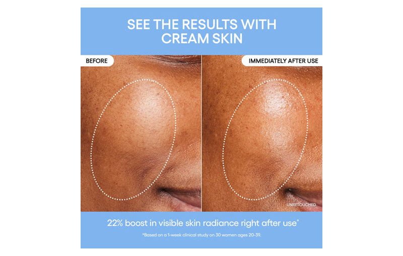 cream skin